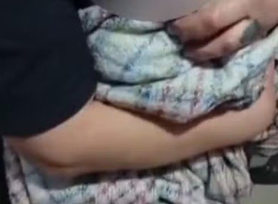 Com fraturas pelo corpo, recém-nascida é encontrada dentro de sacola de lixo em Curitiba