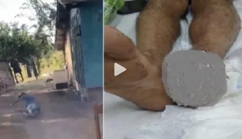 "Vou pisar": o segundo antes da explosão que custou o pé de um homem em Rondônia