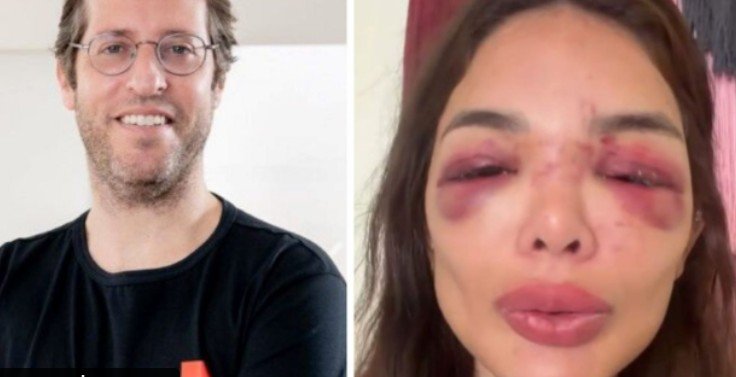 Empresário é preso suspeito de agredir esposa em São Paulo
