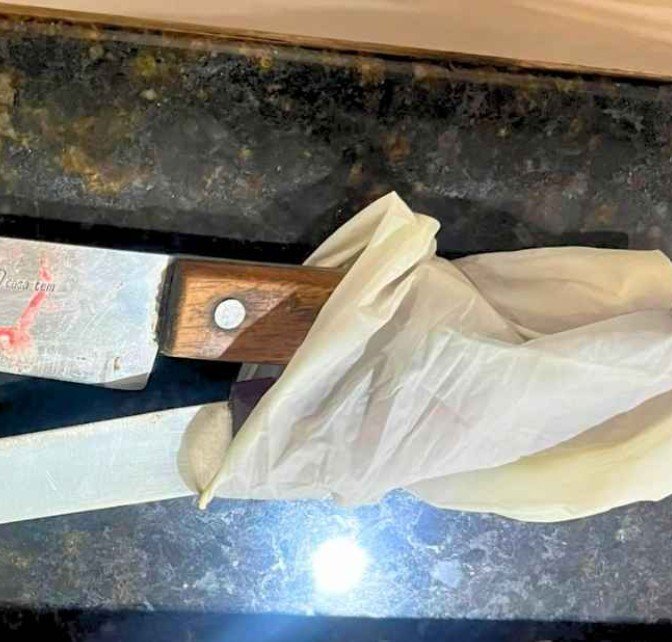 Idoso escapa da morte com ajuda de neto de 11 anos após ataque do próprio filho no Amazonas