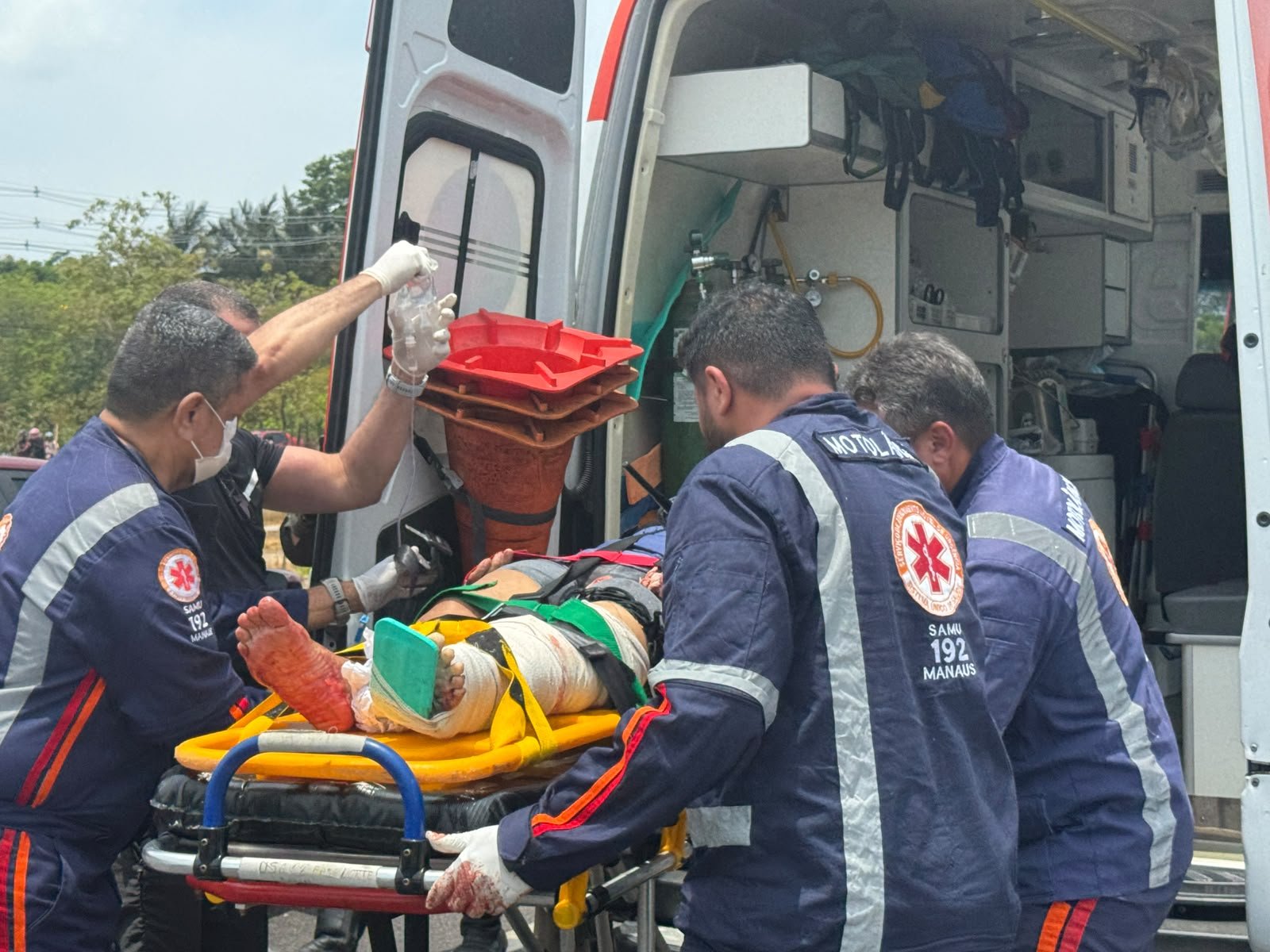 Mulher atropelada por carreta na Av. das Torres sofreu dois esmagamentos e precisou ser reanimada