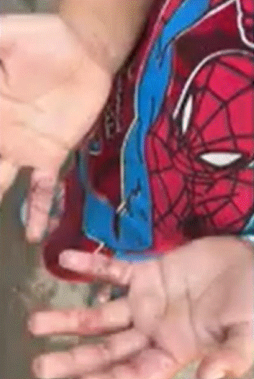 Menino de 5 anos é resgatado com mãos queimadas após suspeita de maus-tratos em Manaus