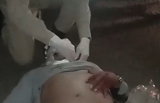 Colisão entre carro e moto deixa duas pessoas feridas na AM-070