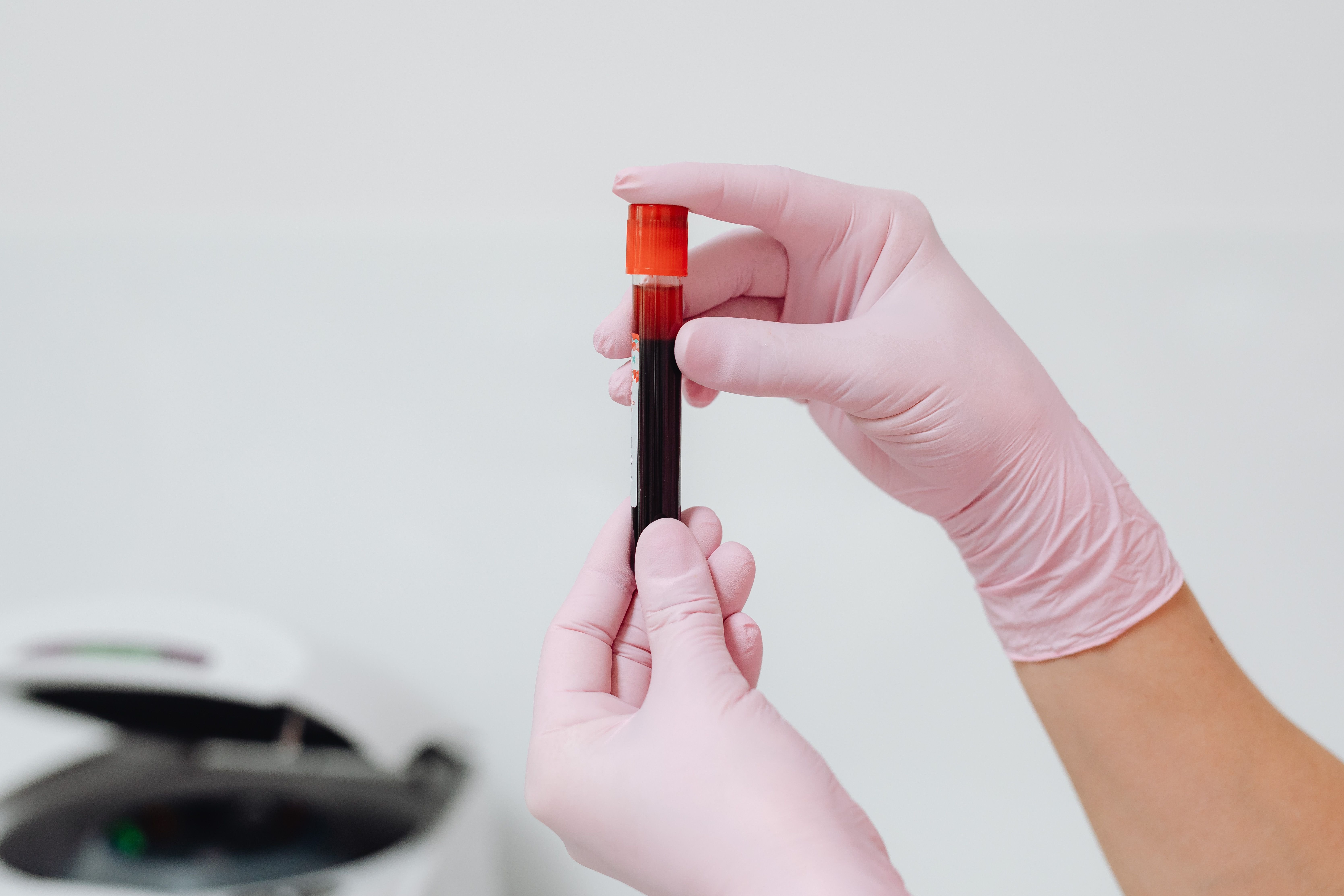 Tratamento de dose única reduz colesterol em até 50%, indica estudo