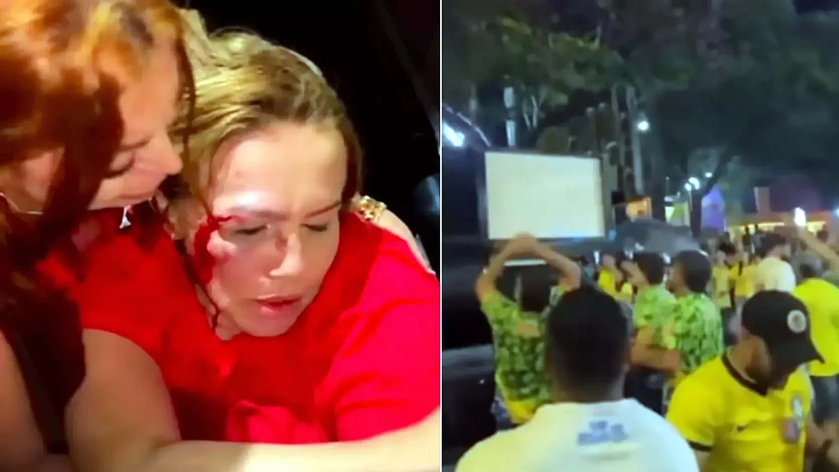Vereadora do PT sofre fratura no nariz após ser atacada a pedradas em carreata em MG