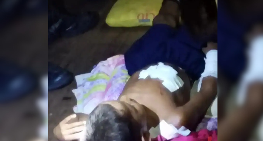 Ataque de jacaré deixa criança ferida em comunidade de Fonte Boa