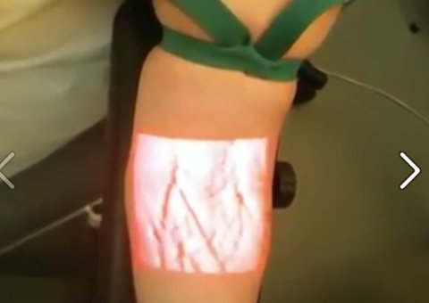 Aparelho com infra vermelho identifica veia para medicação