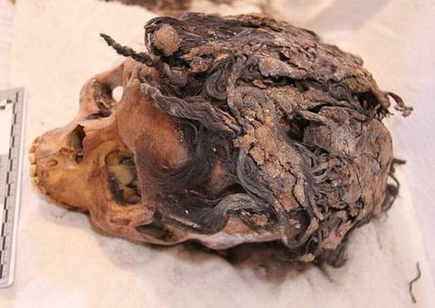 Esqueleto encontrado com aplique capilar