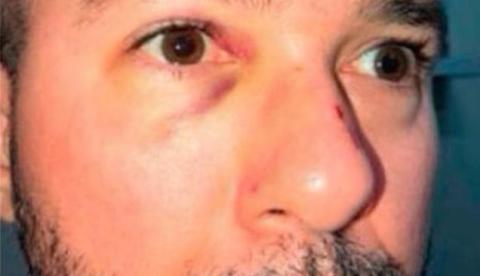 Delegado preso diz que está com dor e pede saída para ir ao médico