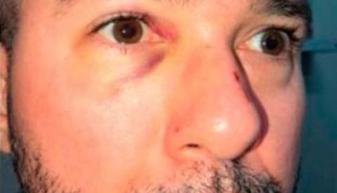 Justiça nega pedido de saída de delegado que matou advogado para atendimento médico