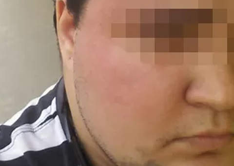 Jovem espancada por ser lésbica e usar barba