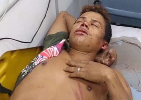 Comparsas fogem, assaltante atira em mototaxista e é agredido