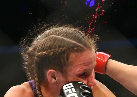 Lutadora com a orelha quase arrancada durante luta UFC 180