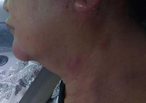 Vídeo: Ataque de abelhas deixa moradores em pânico em São Paulo  