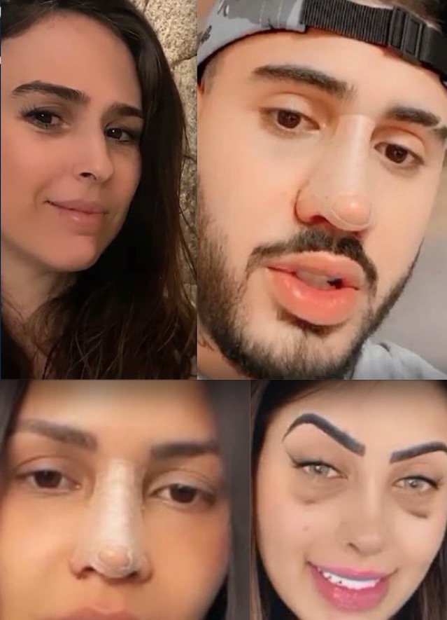   Tatá Werneck alfineta famosos que fizeram plástica no nariz durante pandemia