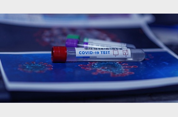 Saiba como fazer o teste diagnóstico de covid-19 pelo plano de saúde