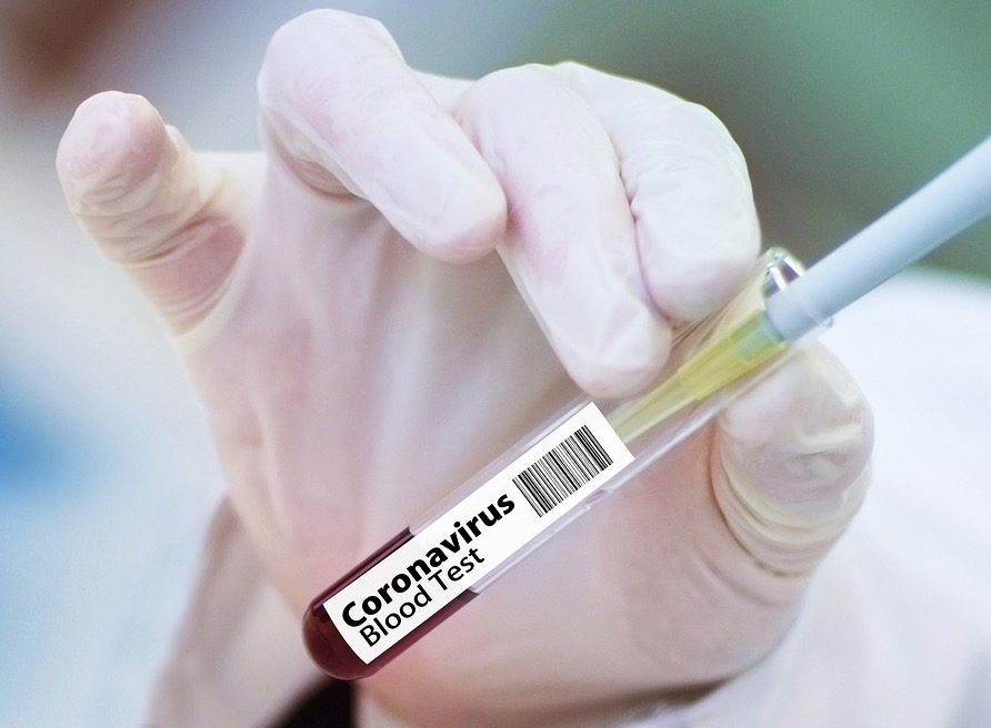 Rússia é acusada de usar hackers para tentar roubar pesquisa de vacina para Covid-19