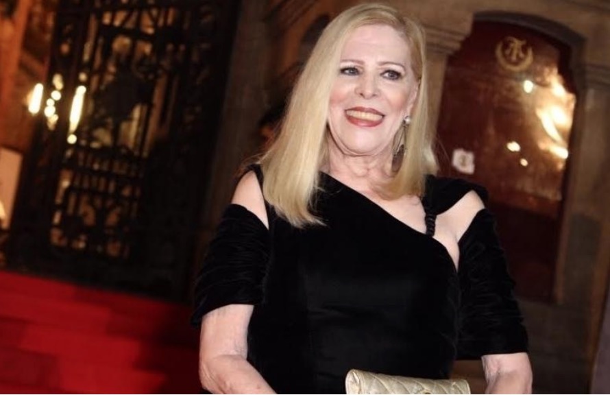 Filha de Vanusa confirma que mãe está com Alzheimer 