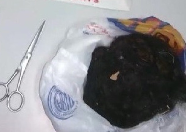 Adolescente fica careca após suposto traficante imaginar traição