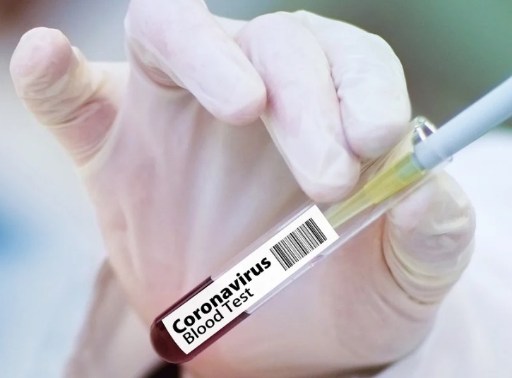 Controle da pandemia no Brasil poderia ser vitória para o mundo, diz OMS