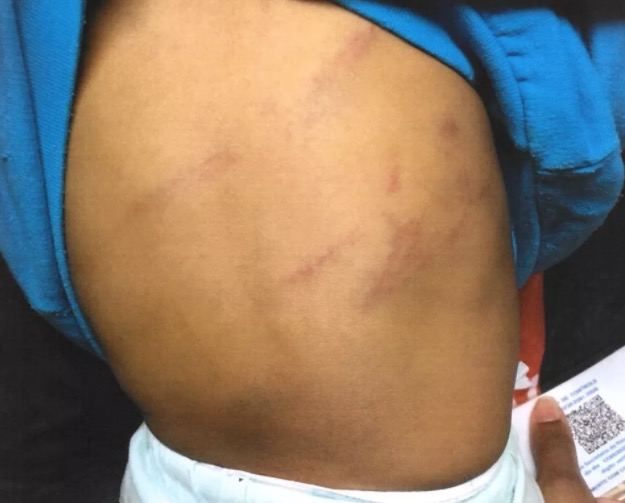 Padrasto é preso por agredir bebê de noves meses com chicote 