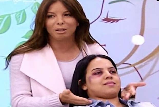 TV ensina tutorial de maquiagem para esconder agressões e causa revolta 