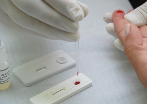 Unidades de saúde oferecem teste rápido de HIV em Manaus