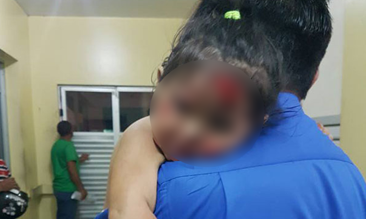 Bandidos agridem mãe e filha durante assalto no AM