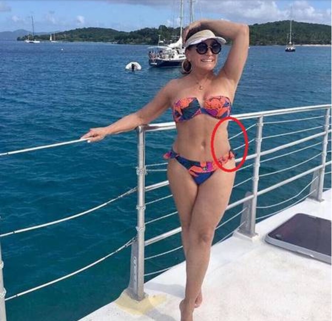 Susana Vieira posa de biquíni e algo chama atenção