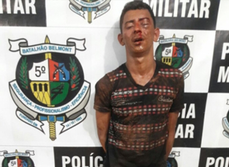 Suspeito de assalto é espancado, mas recusa atendimento médico por medo de agulha