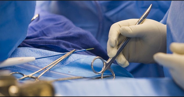 Homem retira do abdômen tesouras esquecidas em cirurgia há 18 anos