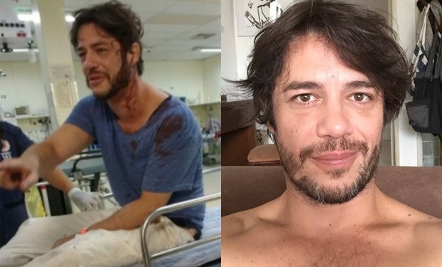 Ator leva paulada na cabeça e vai parar no hospital em BH