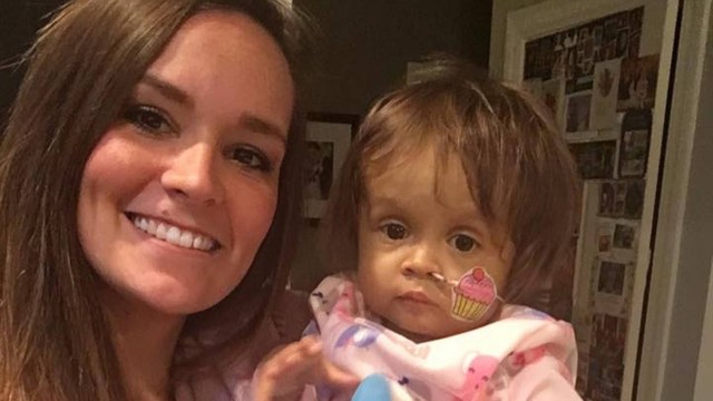 Babá emociona ao doar fígado a garotinha com doença rara