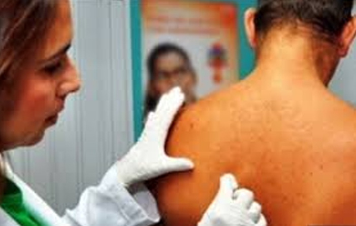 Mutirão oferece consultas dermatológicas gratuitas neste sábado em Manaus