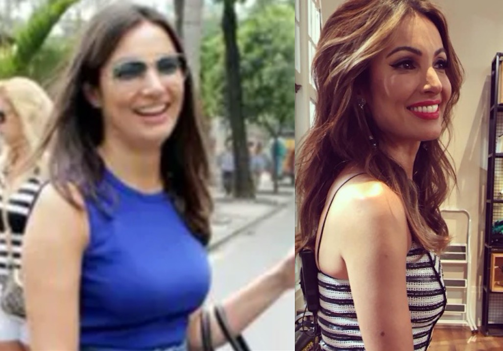 Patrícia Poeta rebate comentários sobre anorexia 'ligaram pra Globo perguntando se estava doente'