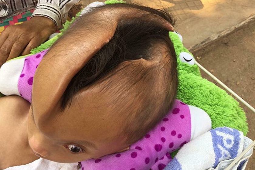Criança surpreende médicos com rachadura surreal na cabeça