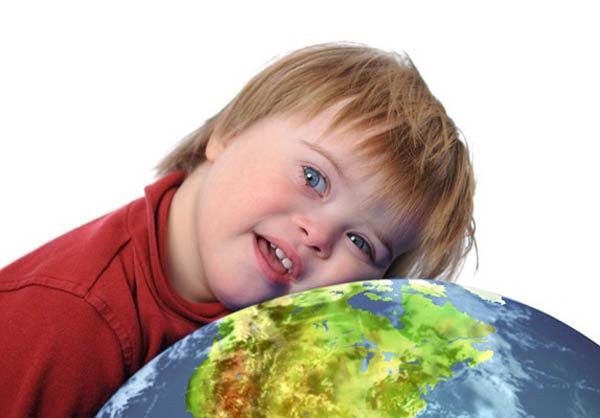  Diagnóstico precoce pode melhorar a qualidade de vida de quem tem Síndrome de Down