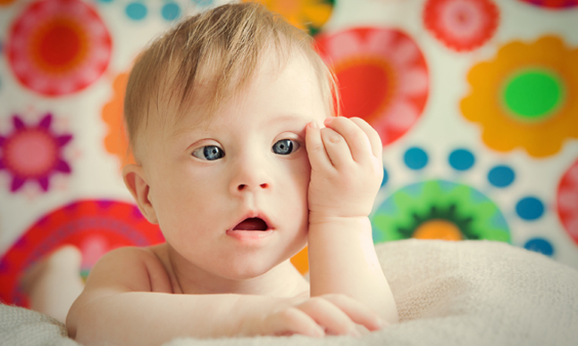 Dia Internacional da síndrome de Down: O carinho é o melhor remédio