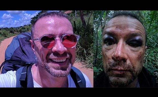 Homem cai de parapente, sobrevive a queda e tira selfie 