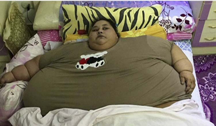  'Mulher mais pesada do mundo', perde 250 kg em dois meses após cirurgia bariátrica