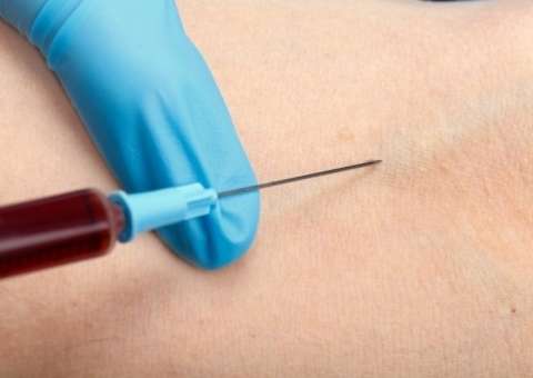 Jejum prolongado não é mais exigido para exames de colesterol e triglicérides