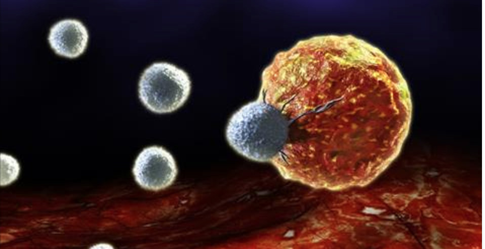 Saiba 10 maiores causas de câncer que você usa todos os dias