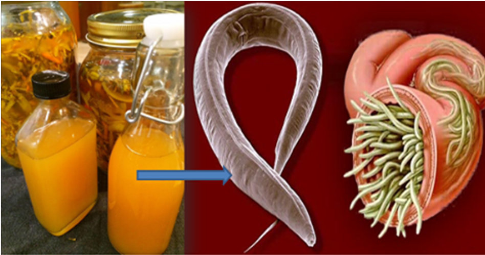 Elimine qualquer tipo de parasita de seu corpo com remédio caseiro