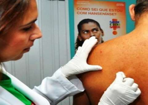 Fundação Alfredo da Matta realiza mutirão dermatológico em Manaus