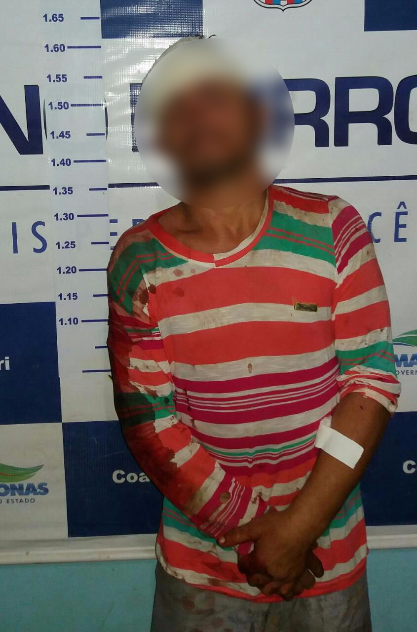 Homem é espancado por populares após roubar e agredir idoso no Amazonas