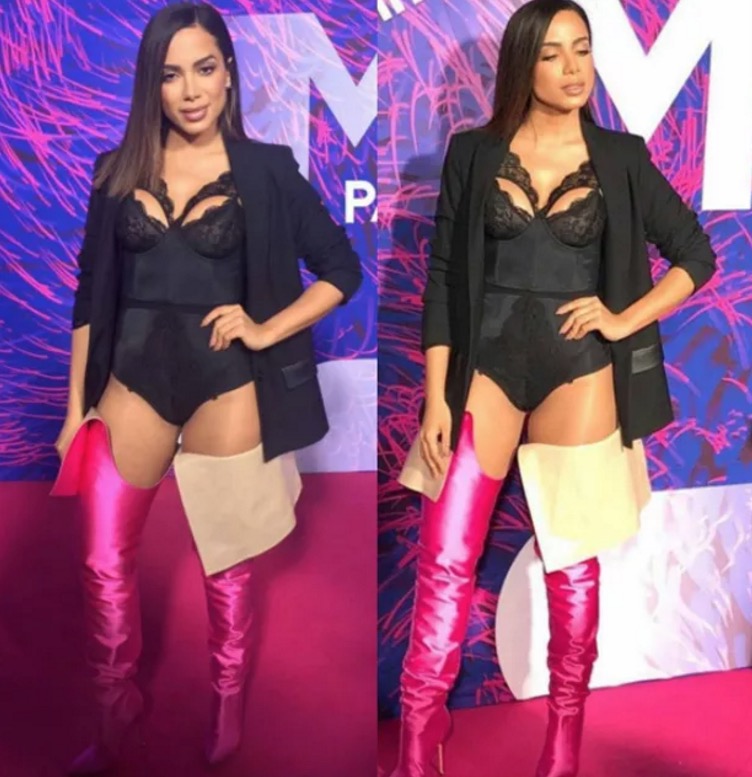 Anitta rouba a cena em premiação da MTV no México; veja o que rolou
