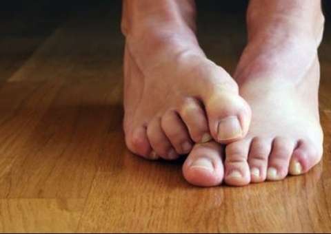 Planta ornamental trata doenças causadas por fungos na pele e unhas 