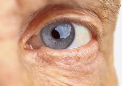 Rica em Vitamina A, consumo de fruta pode combater catarata 