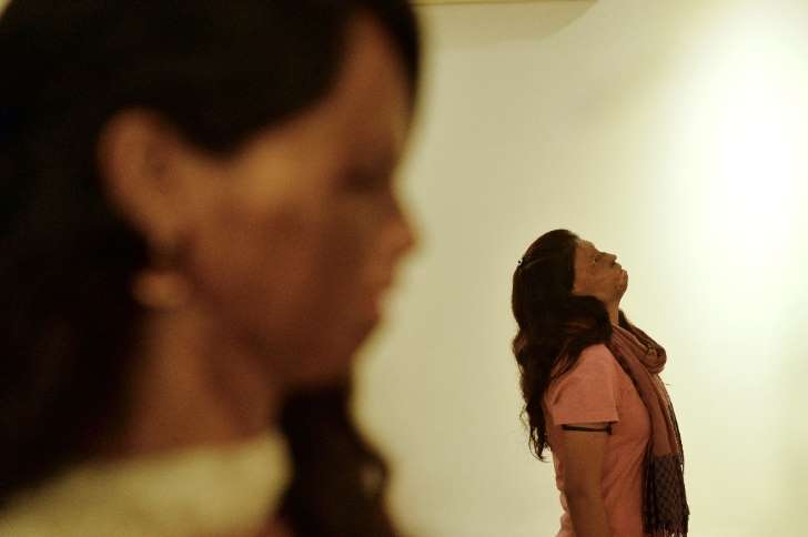 Mulher é atacada com ácido pela quinta vez após sobreviver suposto estupro coletivo