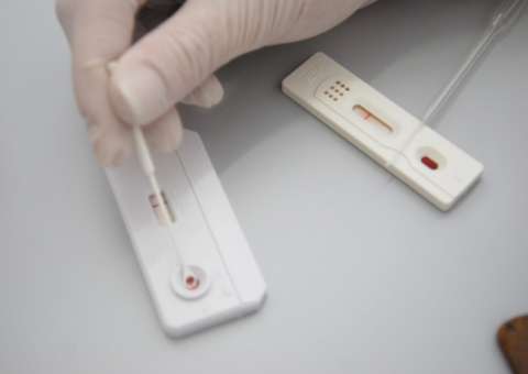 FUAM realiza ação com testes rápidos para diagnóstico de Hepatites Virais